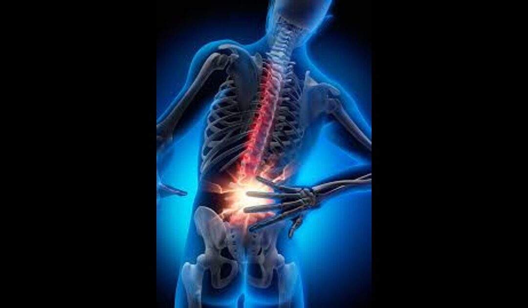 Case Study: Fixing 15 Years of Back Pain