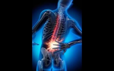 Case Study: Fixing 15 Years of Back Pain